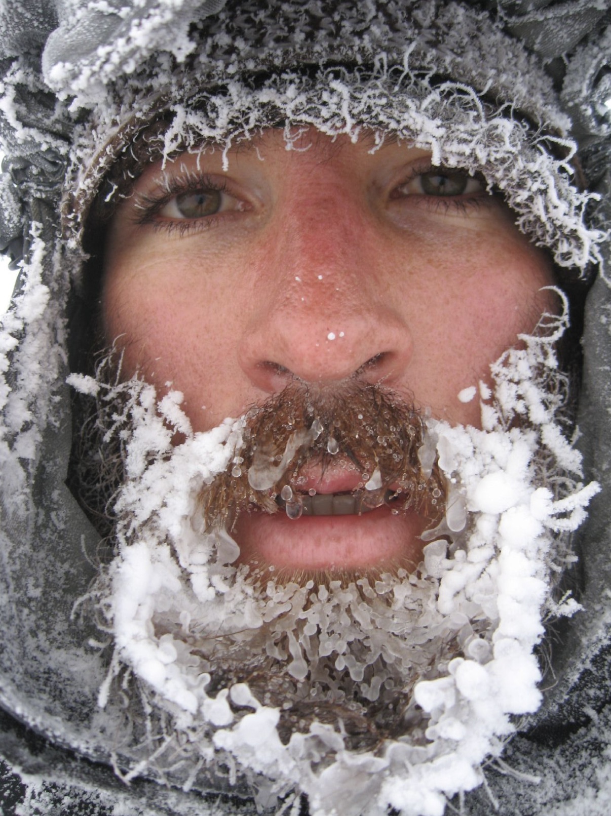 frozen beard